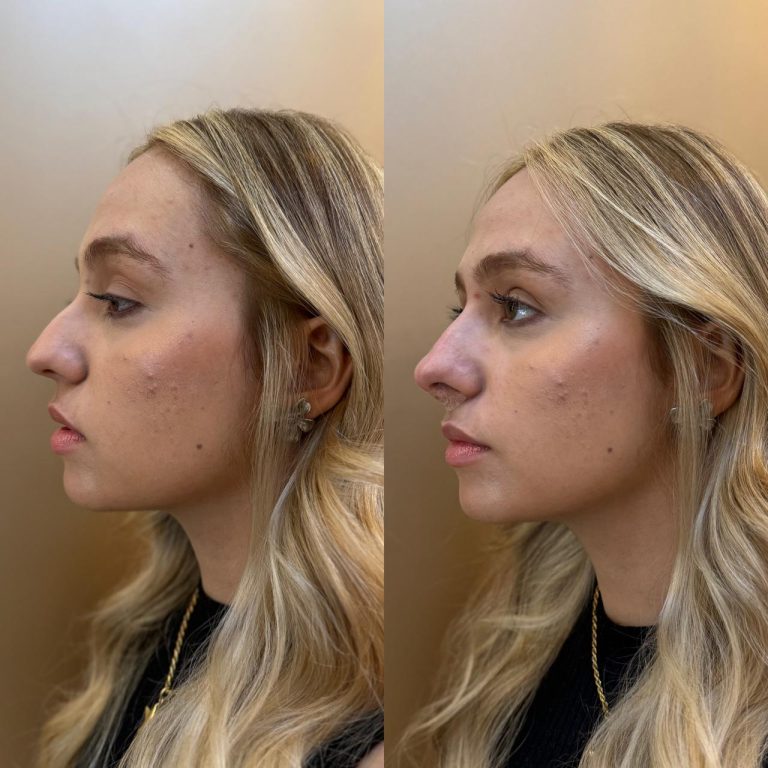 Imagem do WhatsApp de 2025-01-21 à(s) 10.32.40_ad132841